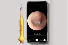خرید گوش پاک‌کن تخصصی گوش شیائومی BEBIRD Ear Cleaner D3 Pro Wierless