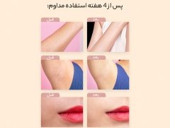 دستگاه لیزر مو برقی خانگی شیائومی Xiaomi Seemagic Laser Permanente Ontharing Machine
