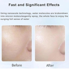 دستگاه فیشیال آبرسان و مرطوب کننده پوست ام دی اچ ال