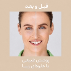 ضد آفتاب صورت رنگی آیسدین