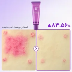 اسنس ضد آفتاب نامبوزین مناسب پوست آسیب دیده