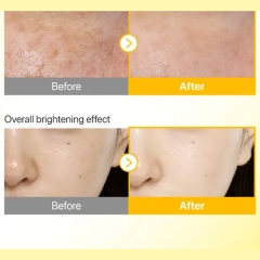 فروش سرم ضد آفتاب نامبوزین  تون آپ SPF50+