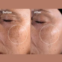 تونر اوردینری لایه بردار و شفاف کننده پوست