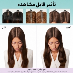 تاثیر شامپو متعادل کننده چربی لورآل