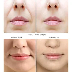 فروش ابزار تمرین عضلات صورت زد فیس