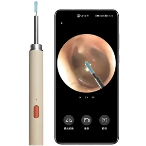 گوش پاک‌ کن هوشمند شیائومی Xiaomi Zdeer مدل ZD-CEB-6 دوربین‌ دار