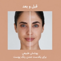 قبل و بعد کرم ضد آفتاب رنگی آیسدین