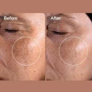 تونر گلیکولیک اسید 7% اوردینری Ordinary لایه بردار و شفاف کننده مناسب انواع پوست