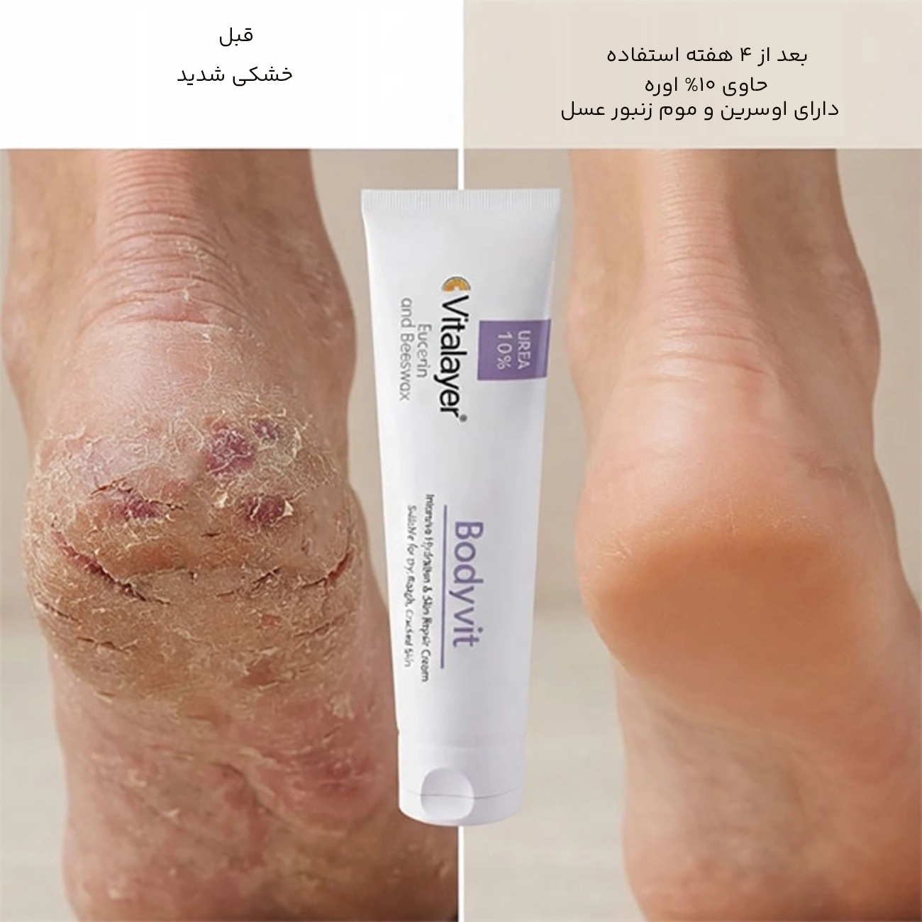 کرم ترمیم کننده
