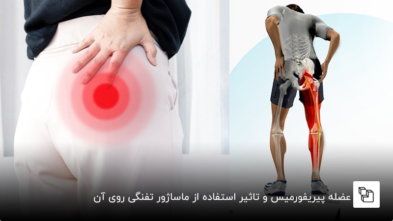 عضله پیریفورمیس و تاثیر استفاده از ماساژور تفنگی روی آن